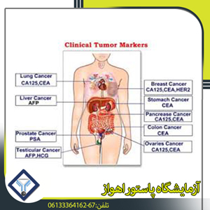 علامات الأورام